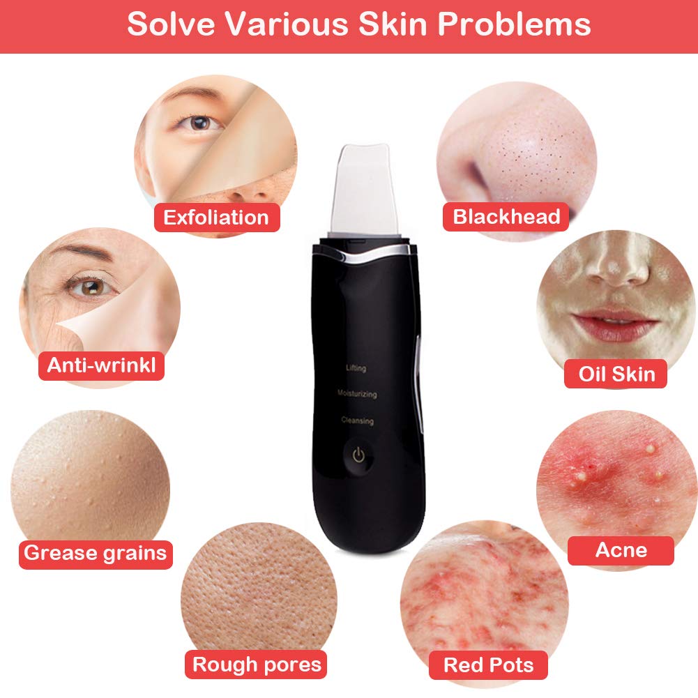 Rechargeable Ultrasonic Skin Scrubber and Blackhead Remover